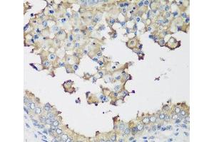 Immunohistochemistry of paraffin-embedded Human prostate using NEDD4L Polyclonal Antibody at dilution of 1:200 (40x lens). (NEDD4-2 antibody)