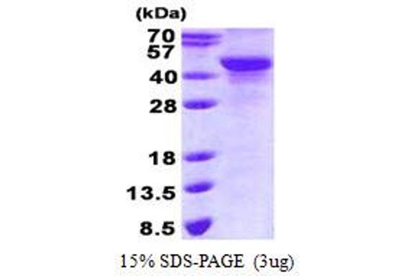 NDRG2 Protein (His tag)