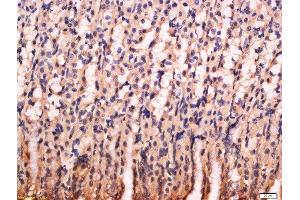 Formalin-fixed and paraffin embedded rat stomach labeled with Anti-PG-C/Pepsinogen 2 Polyclonal Antibody, Unconjugated  at 1:200 followed by conjugation to the secondary antibody and DAB staining.