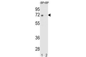 Western blot analysis of ER antibody pre-incubated without (Lane 1) and with (2) blocking peptide in K562 lysate.