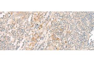 Immunohistochemistry of paraffin-embedded Human tonsil tissue using HBE1 Polyclonal Antibody at dilution of 1:30(x200) (Hemoglobin, epsilon 1 (HBe1) antibody)