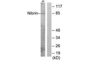 Western blot analysis of extracts from Jurkat cells, using Nibrin (Ab-278) Antibody.