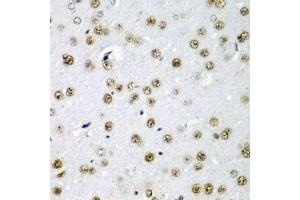 Immunohistochemistry of paraffin-embedded rat brain using SF3B3/S antibody (ABIN6128696, ABIN6147668, ABIN6147669 and ABIN6221751) at dilution of 1:200 (40x lens). (SF3B3 antibody  (AA 948-1217))