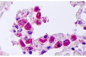 Anti-TNFSF10 / TRAIL antibody IHC staining of human lung, macrophages. (TRAIL antibody)