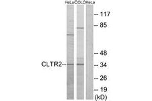 Western blot analysis of extracts from HeLa/COLO cells, using CLTR2 Antibody. (CasLTR2 antibody  (AA 281-330))