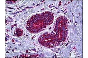 Human Breast: Formalin-Fixed, Paraffin-Embedded (FFPE) (MT-ATP6 antibody  (Subunit alpha))