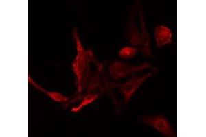 ABIN6275480 staining NIH-3T3 cells by IF/ICC. (RGS14 antibody  (Internal Region))
