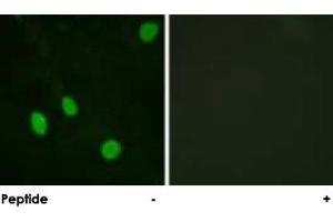 Immunofluorescence analysis of HeLa cells, using CCNH polyclonal antibody . (Cyclin H antibody)