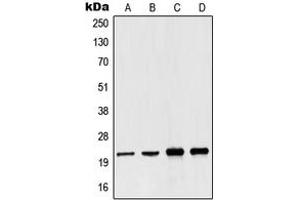 Western blot analysis of NDUFB10 expression in Jurkat (A), A431 (B), Raji (C), HepG2 (D) whole cell lysates. (NDUFB10 antibody  (Center))