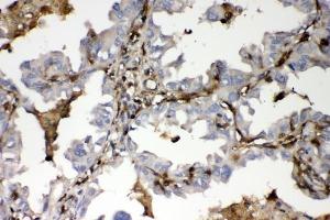 IHC analysis of S100A4 using anti-S100A4 antibody (ABIN7600462). (s100a4 antibody  (AA 2-101))