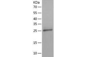 Western Blotting (WB) image for HAUS Augmin-Like Complex, Subunit 1 (HAUS1) (AA 1-278) protein (His tag) (ABIN7288290) (HAUS1 Protein (AA 1-278) (His tag))