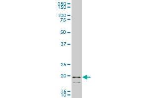 ARL1 polyclonal antibody (A01), Lot # EGC0060125QCS1 Western Blot analysis of ARL1 expression in Hela S3 NE ( Cat # L013V3 ). (ARL1 antibody  (AA 72-181))