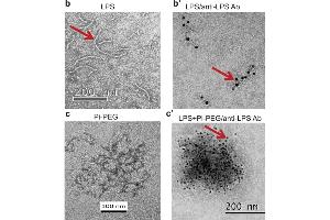 immunoelectron microscopy (IEM) images of LPS using ABIN479062. (Lipopolysaccharides (LPS) antibody)