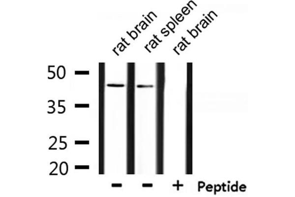 ZADH2 antibody  (Internal Region)