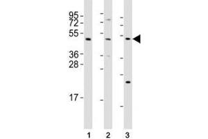 Western blot testing of Mlkl antibody at 1:2000 dilution and mouse samples: (1) testis, (2) liver, (3) NIH3T3 lysate; Predicted size: 54 kDa. (MLKL antibody  (AA 444-472))