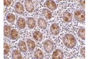 Immunohistochemistry of AATF in human small intestine tissue with AATF antibody at 10 μg/ml. (AATF antibody)