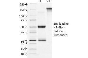 SDS-PAGE Analysis Purified CD71 Mouse Monoclonal Antibody (TFRC/1396). (Transferrin Receptor antibody)