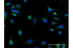 Immunofluorescence of purified MaxPab antibody to DIAPH1 on HeLa cell. (DIAPH1 antibody  (AA 1-404))