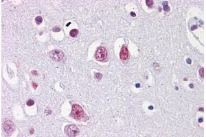 Human Brain, cortex: Formalin-Fixed, Paraffin-Embedded (FFPE) (EMX2 antibody  (AA 103-201))