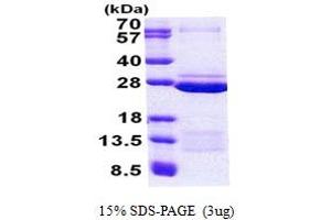 SDS-PAGE (SDS) image for Family with Sequence Similarity 50, Member A (FAM50A) (AA 150-339) protein (His tag) (ABIN5852994)