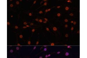 Immunofluorescence analysis of C6 cells using Phospho-Histone H3(T11) Polyclonal Antibody at dilution of 1:100.
