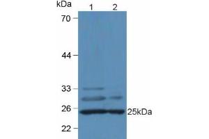 Western blot analysis of (1) Mouse Heart Tissue and (2) Mouse Liver Tissue. (C1QA antibody  (AA 23-245))