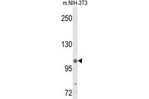 Western Blotting (WB) image for anti-Lysine (K)-Specific Demethylase 4B (KDM4B) antibody (ABIN3004253)
