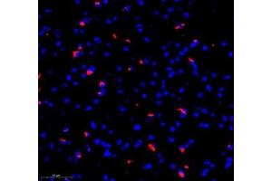 Immunofluorescence of paraffin embedded mouse brain using MAP7 (ABIN7074621) at dilution of 1:400 (300x lens) (MAP7 antibody)