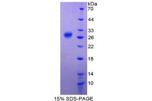 SDS-PAGE (SDS) image for Raftlin, Lipid Raft Linker 1 (RFTN1) (AA 288-520) protein (His tag) (ABIN1981257)