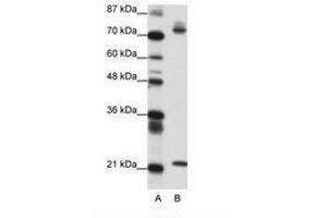 Image no. 1 for anti-SATB Homeobox 1 (SATB1) (AA 611-660) antibody (ABIN6736150) (SATB1 antibody  (AA 611-660))
