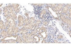 Detection of ESM1 in Human Kidney Tissue using Polyclonal Antibody to Endothelial Cell Specific Molecule 1 (ESM1) (ESM1 antibody  (AA 20-184))