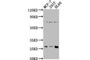 Western Blot Positive WB detected in: MCF-7 whole cell lysate, 293T whole cell lysate, HL60 whole cell lysate All lanes: STYX antibody at 1:1000 Secondary Goat polyclonal to rabbit IgG at 1/50000 dilution Predicted band size: 26 kDa Observed band size: 26 kDa (STYX antibody  (AA 1-223))