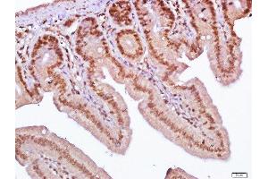 Paraformaldehyde-fixed, paraffin embedded mouse small intestine, Antigen retrieval by boiling in sodium citrate buffer (pH6. (SLC38A2 antibody  (AA 21-150))