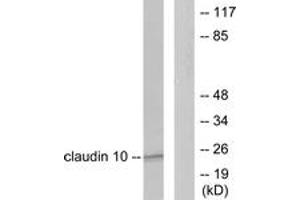 Western blot analysis of extracts from LOVO cells, using Claudin 10 Antibody. (CLDN10 antibody  (AA 179-228))