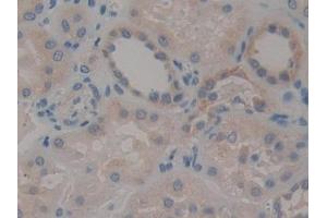Detection of STAT2 in Human Kidney Tissue using Polyclonal Antibody to Signal Transducer And Activator Of Transcription 2 (STAT2) (STAT2 antibody  (AA 616-849))