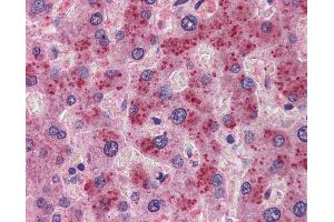 Anti-FGF21 antibody IHC of human liver. (FGF21 antibody  (N-Term))