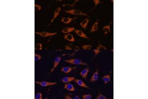 Immunofluorescence analysis of L929 cells using SM antibody (ABIN7270612) at dilution of 1:100. (SMAP1 antibody  (AA 180-250))
