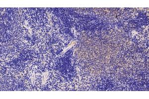 Immunohistochemistry (IHC) image for anti-Lipocalin 2 (LCN2) (AA 21-198) antibody (ABIN7433588)