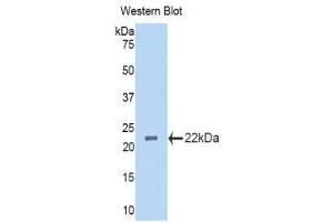 Western Blotting (WB) image for anti-Interleukin 3 Receptor, alpha (IL3RA) (AA 167-331) antibody (ABIN1859425) (IL3RA antibody  (AA 167-331))