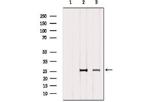 Western blot analysis of extracts from various samples, using CD81 Antibody.