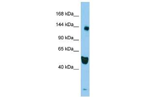 Host: Rabbit Target Name: RASAL2 Sample Type: HepG2 Whole Cell lysates Antibody Dilution: 1.