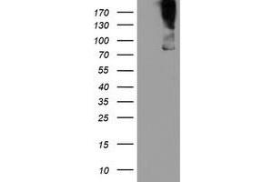 Western Blotting (WB) image for anti-Zinc Finger, BED-Type Containing 1 (ZBED1) antibody (ABIN1501794) (ZBED1 antibody)