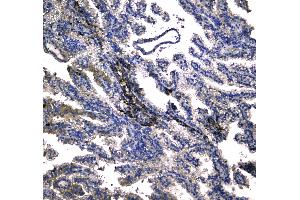 IHC analysis of NADPH oxidase 4 using anti-NADPH oxidase 4 antibody . (NADPH Oxidase 4 antibody)