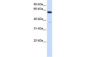 Human Heart; WB Suggested Anti-ALG6 Antibody Titration: 0. (ALG6 antibody  (N-Term))