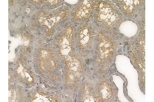 ABIN6260779 and ABIN6273207 at 1/100 staining human normal kidney tissue by IHC-P. (CFHR3 antibody  (Internal Region))