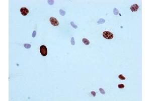 Immunocytochemistry (ICC) image for anti-Histone Cluster 1, H3a (HIST1H3A) (pSer10) antibody (ABIN7127310)