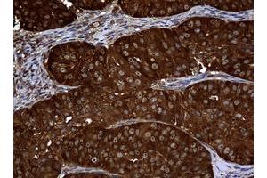 Image no. 1 for anti-Non-Metastatic Cells 1, Protein (NM23A) Expressed in (NME1) antibody (ABIN1499754) (NME1 antibody)