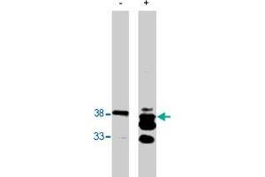 Western blot analysis using PPAP2B polyclonal antibody  on bacterially expressed PPAP2B protein when untreated (-) and treated with with 0.