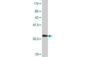 Western Blot detection against Immunogen (37. (CA12 antibody  (AA 25-124))