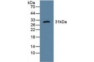 Detection of LOX1 in Human Urine using Polyclonal Antibody to Lectin Like Oxidized Low Density Lipoprotein Receptor 1 (LOX1) (OLR1 antibody  (AA 81-273))